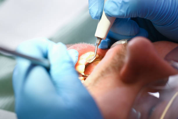 Professional Emergency Dentist in HI