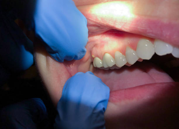 Best Urgent Care for Lost Fillings or Crowns in Holualoa, HI